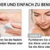 4er Mitesserentferner Komedonenquetscher Set – Bild 2
